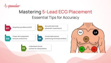 leads ecg